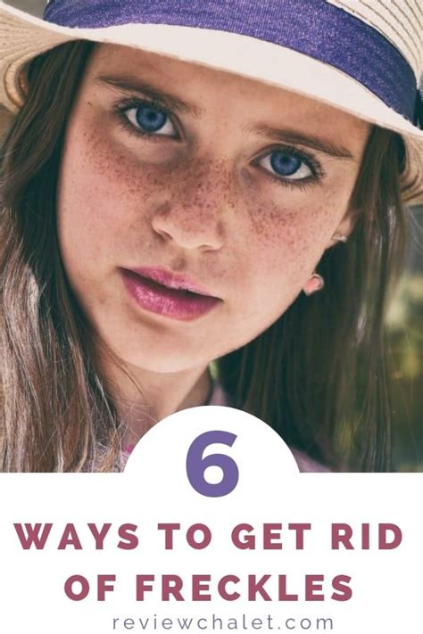 If You Wonder How To Get Rid Of Freckles You Ll Love These 6 Easy Ways Freckles