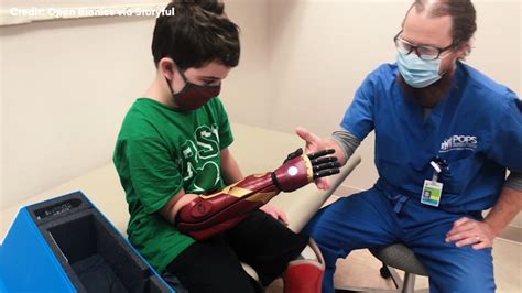 8 Year Old Amputee From Massachusetts Gets Iron Man Themed Bionic Arm