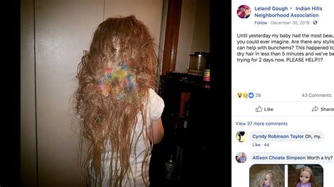 Over 50 Bunchems Tangled In Hair Arkansas Mom Warns Parents About Toy