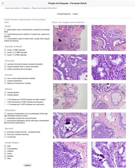 Histopathological Grading Of Breast Ductal Carcinoma In Situ