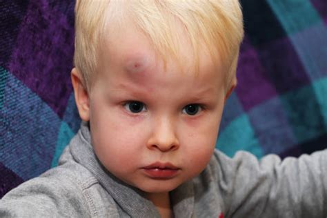 Baby Hit Forehead On Tile Floor Flooring Tips