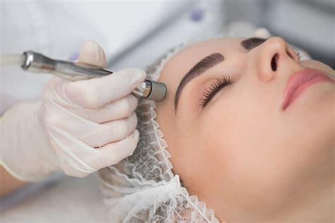 The Benefits Of Microdermabrasion In Milton Sagamore Hills Township