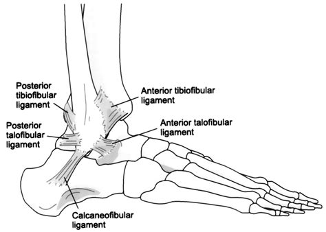 This diagram depicts knee tendon diagram and explains the details of knee tendon diagram. Ankle Injury