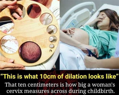 “this Is What 10cm Of Dilation Looks Like That Ten Centimeters Is How Big A Womans Cervix