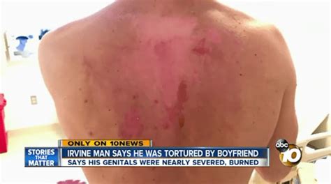 Man Almost Had Genitals Cut Off After Argument Turned Into Satanic Torture Metro News