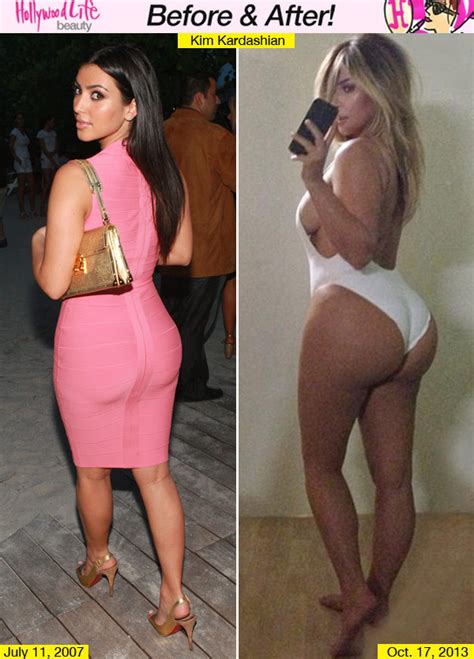 Kim Kardashian Butt Implants — Has She Injected Fat Into Her Bottom