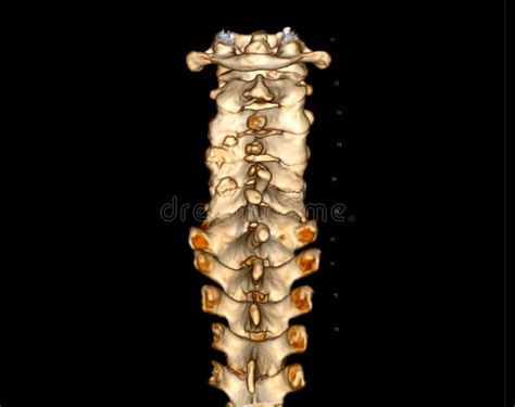 Ct Scan Of C Spine Or Cervical Spine 3d Rendering Stock Illustration