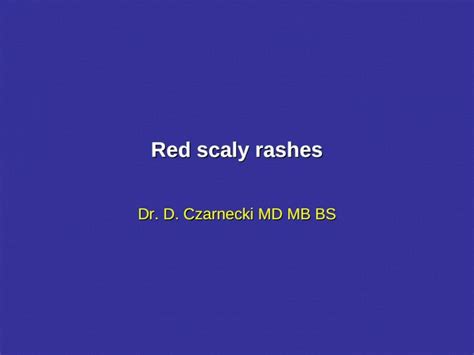 Ppt Red Scaly Rashes Dr D Czarnecki Md Mb Bs Red Scaly Rashes When