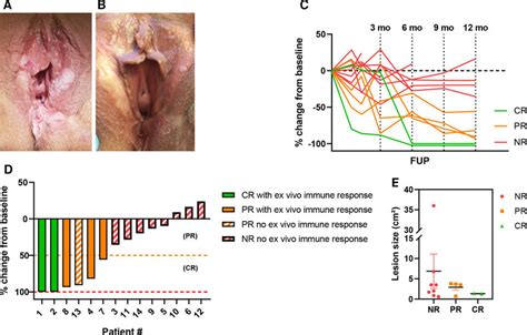 Clinical Response Data Of Cohort 1 And 2 A Usual Vulvar