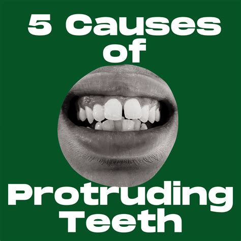 5 Causes Of Protruding Teeth Acorn Dentistry For Kids