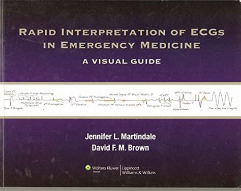 Rapid Interpretation Of Ecgs In Emergency Medicine A Visual Guide
