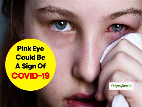 Is Pink Eye A Potential Symptom Of Coronavirus Know How