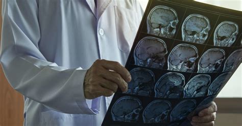 Ventriculoperitoneal Shunt Types Procedure Risks And Recovery