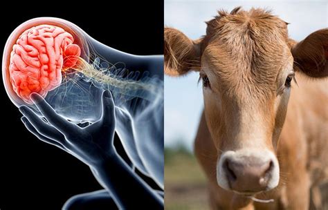 ¿qué Es La Enfermedad De Las Vacas Locas Y Cómo Se Contrae