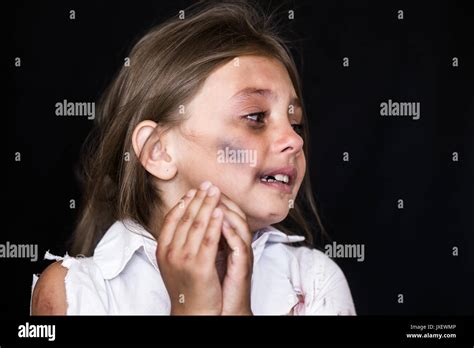 Child Abuse Sad And Lonely Girl Crying Injured Child Posing As Stock