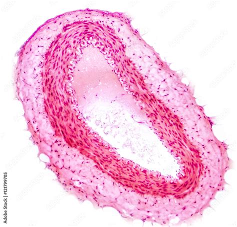 Light Micrograph Of A Muscular Artery Artery Has Thicker Wall Than Vein Light Microscopy