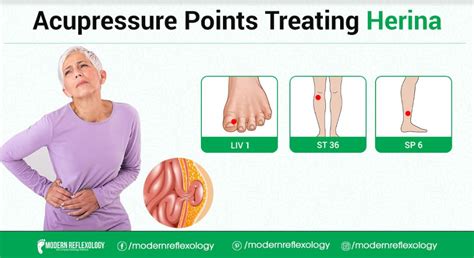 Best Acupressure Points For Treating Hernia Modern Reflexology