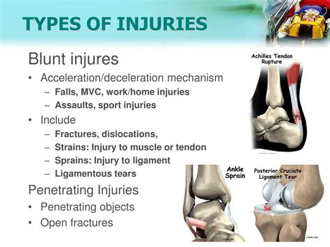 Ppt Musculoskeletal Trauma Powerpoint Presentation Free Download