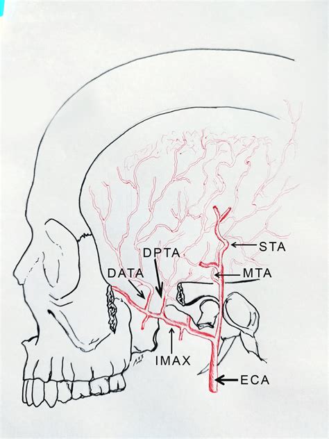 A Lateral View Schematic Drawing Of The Disposition Of The Temporal