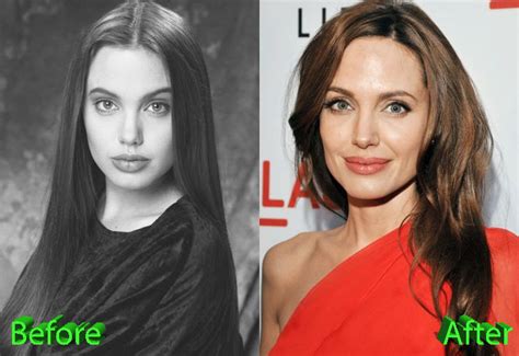Джоли До Операций И После Фото Telegraph
