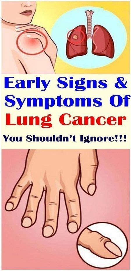 7 Warning Signs Of Lung Cancer Not To Ignore Wellness Tab