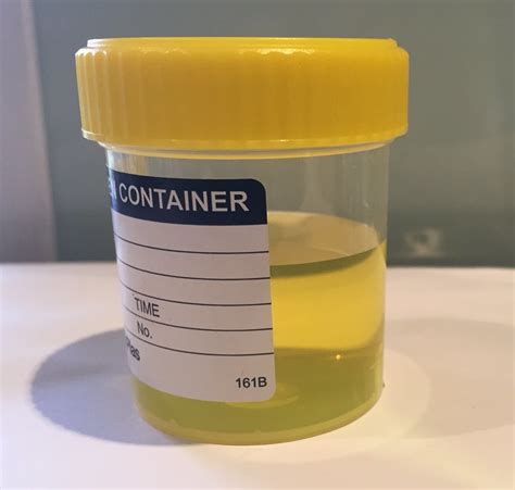 Normal Ph Of Urine The Alkaline Way Integrative Management Of