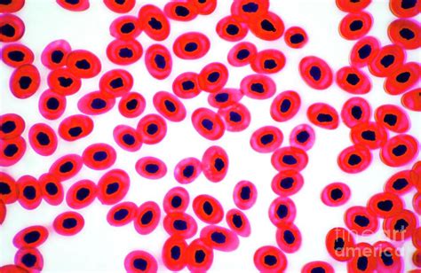 Red Blood Cells Of A Common Frog Photograph By Nigel Downerscience