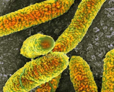 Escherichia Coli Bacteria — Microbial Micrograph Stock Photo