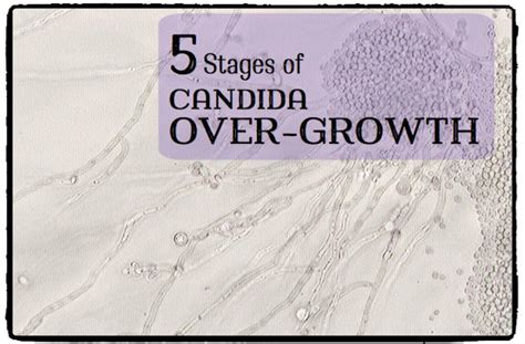 The 5 Stages Of Candida Overgrowth Hubpages