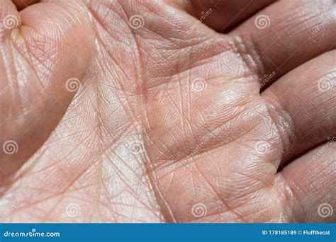 Close Up Of A Man`s Left Hand Showing Palm Skin Lines And Pattern