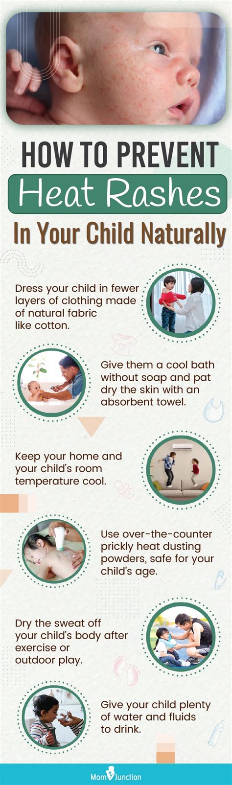 Heat Rashes In Children How To Treat And Prevent Them Momjunction