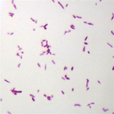 Gram Negative Bacillus Slide Wm Gram Stain