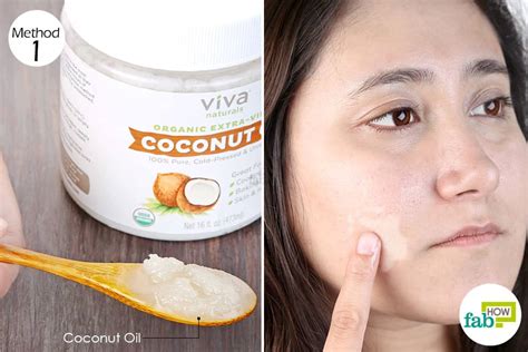 Top 10 Home Remedies To Get Rid Of Vitiligo White Skin Patches Fab How