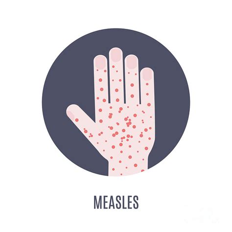 Measles Awareness Photograph By Art4stockscience Photo Library Fine