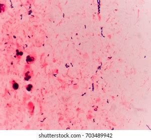 Bacteria Cells Gram Positive Cocci Chain Stock Photo Shutterstock