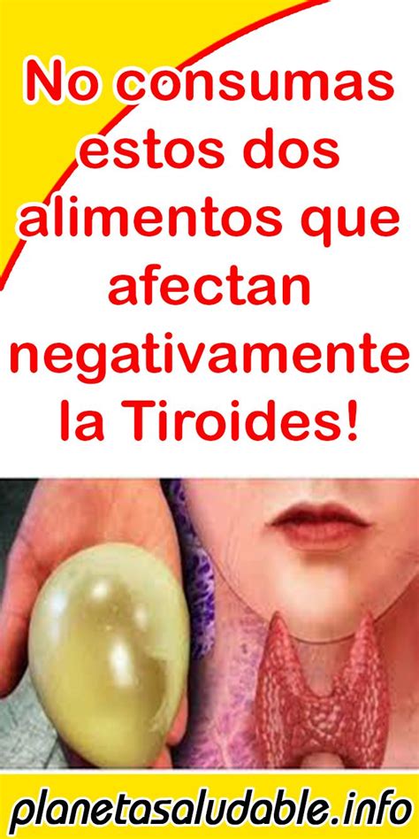 No Consumas Estos Dos Alimentos Que Afectan Negativamente La Tiroides