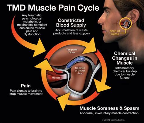 Tmj How To Relieve Jaw And Neck Pain Today