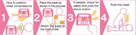 The Japanese Circulation Societycall And Push Simplified Cpr Procedure