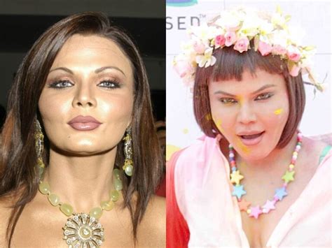 Rakhi Sawant Before And After Plastic Surgery Plastic Surgery Stars