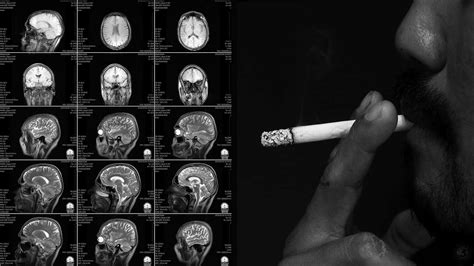 Heres How Nicotine Impacts The Brain 6 Minute Read