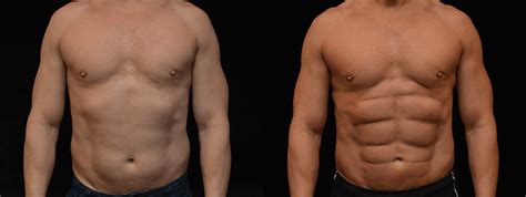 Six Pack Abs Before And After