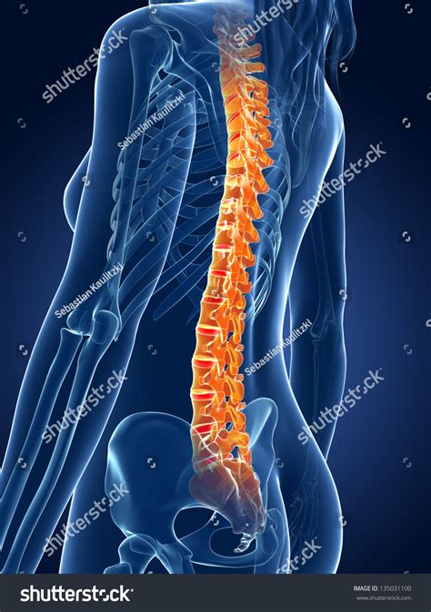 3d Rendered Medical Illustration Painful Spine 135031100 Shutterstock
