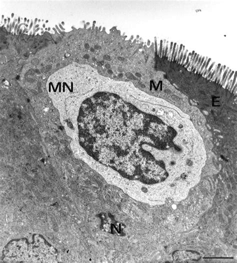 Human Intestinal M Cells Exhibit Enterocyte Like Intermediate Filaments