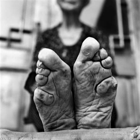 Last Living Chinese Women With Bound Feet Pictured Daily Mail Online