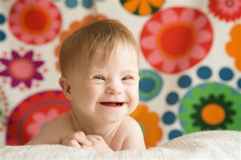 Bebê com síndrome de Down principais informações Vida Saudável