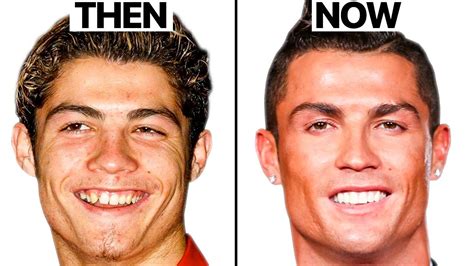 Cristiano Ronaldo NEW FACE Plastic Surgery Analysis YouTube