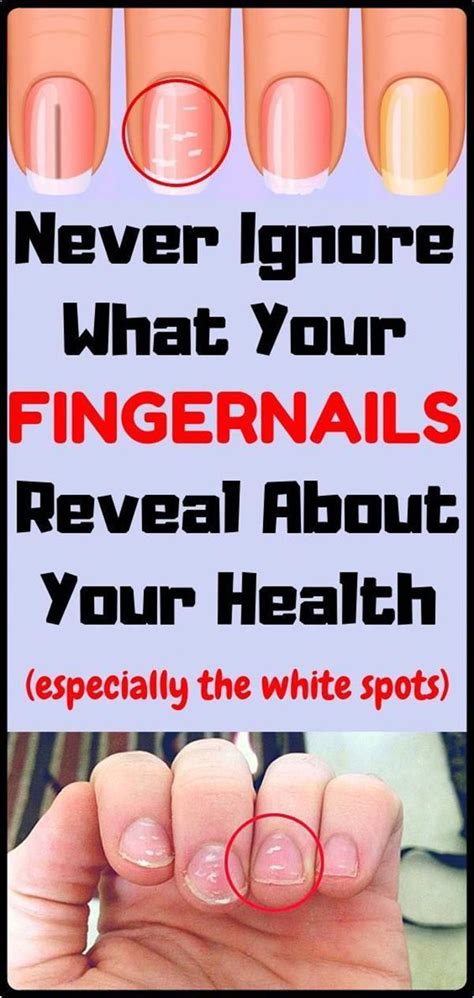 This Is What Your Fingernails Say About Your Health In 2020