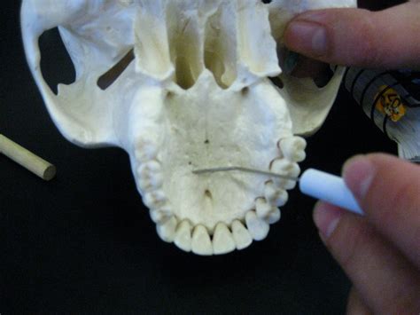Boned Human Skull Palatine Process Of Maxilla
