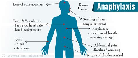 Anaphylaxis Causes