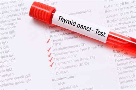 Thyroid Panel Test A Comprehensive Guide To Thyroid Health Speedy
